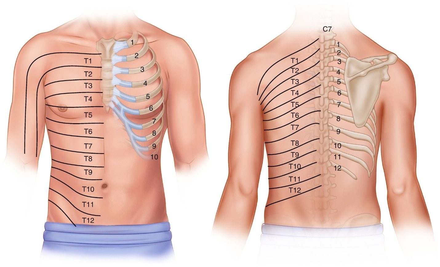 đau dây thần kinh liên sườn