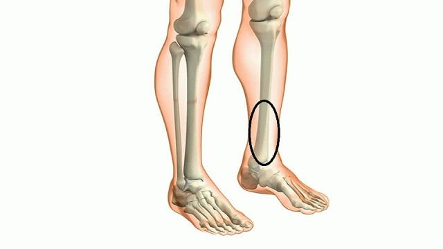 Đau nhức xương ống chân cảnh báo bệnh gì, điều trị thế nào?
